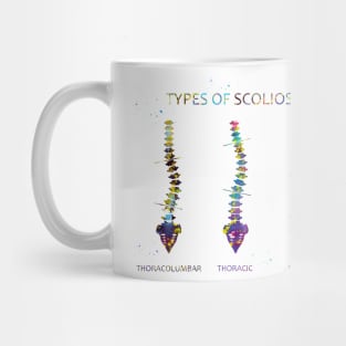 Type of scoliosis of spine Mug